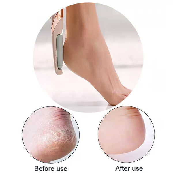 Grandeur Grove™ Electric Callus Remover